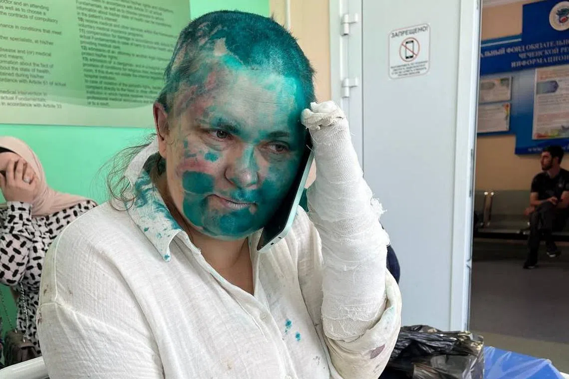 Russian investigative journalist Yelena Milashina speaking on a mobile phone at a hospital in the Chechen capital Grozny after she was assaulted.