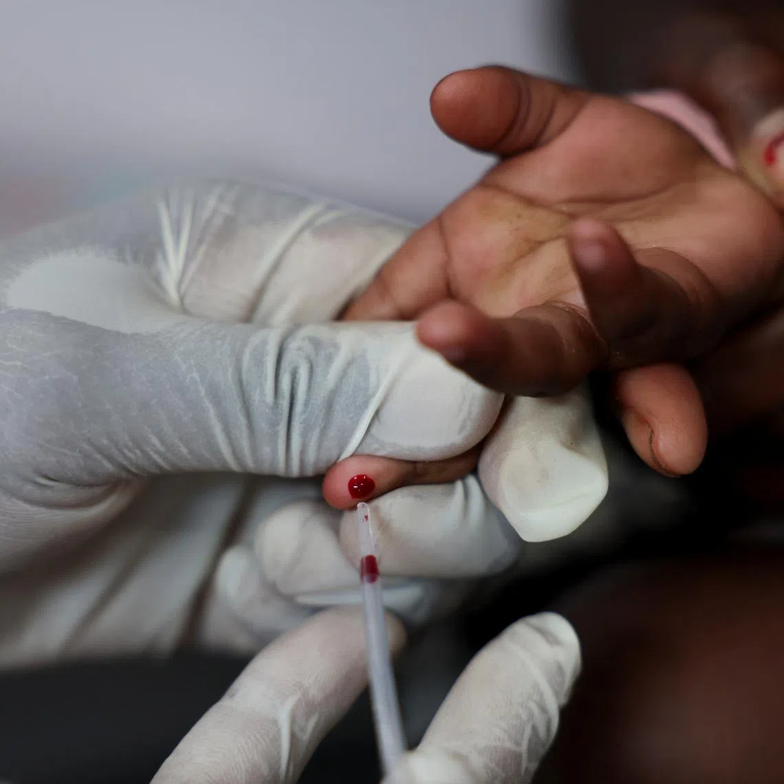 Infections are likely to shoot up as funding cuts have shuttered prevention and treatment programmes