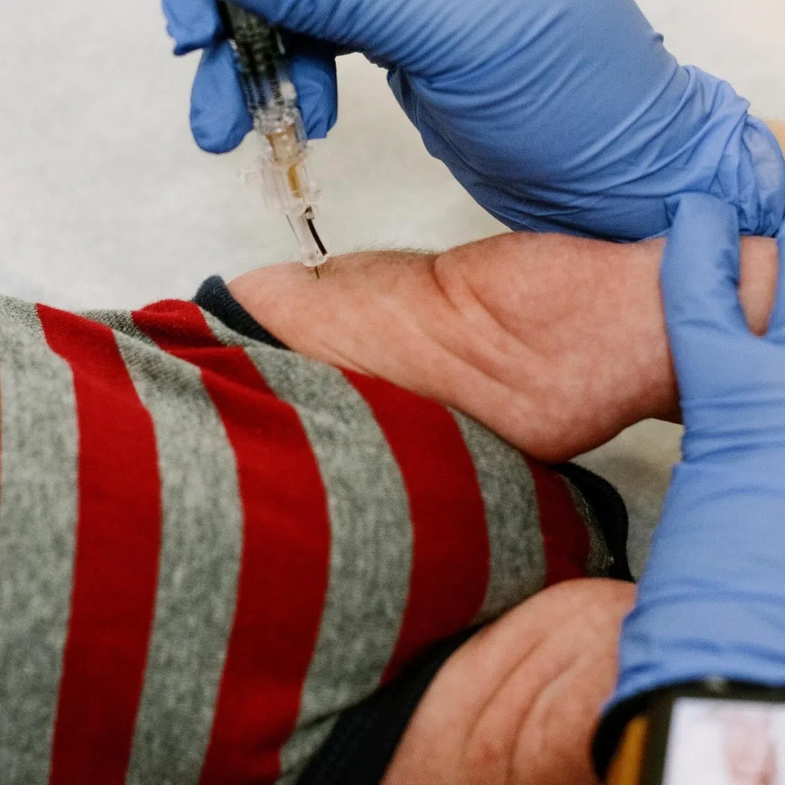 Some 3.5 million American children a year are recommended to get vaccinated against hepatitis B on the day of their birth.