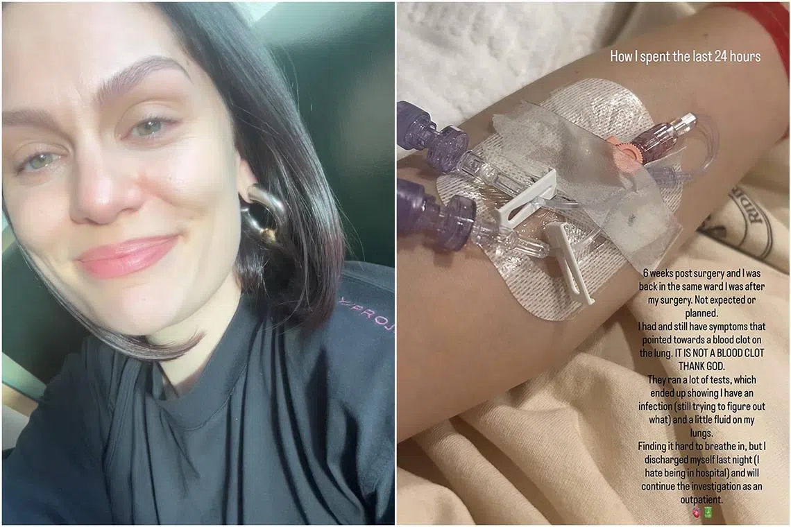 Jessie J (above) shared a photo on Instagram Stories from her hospital bed with an IV canula in her arm.
