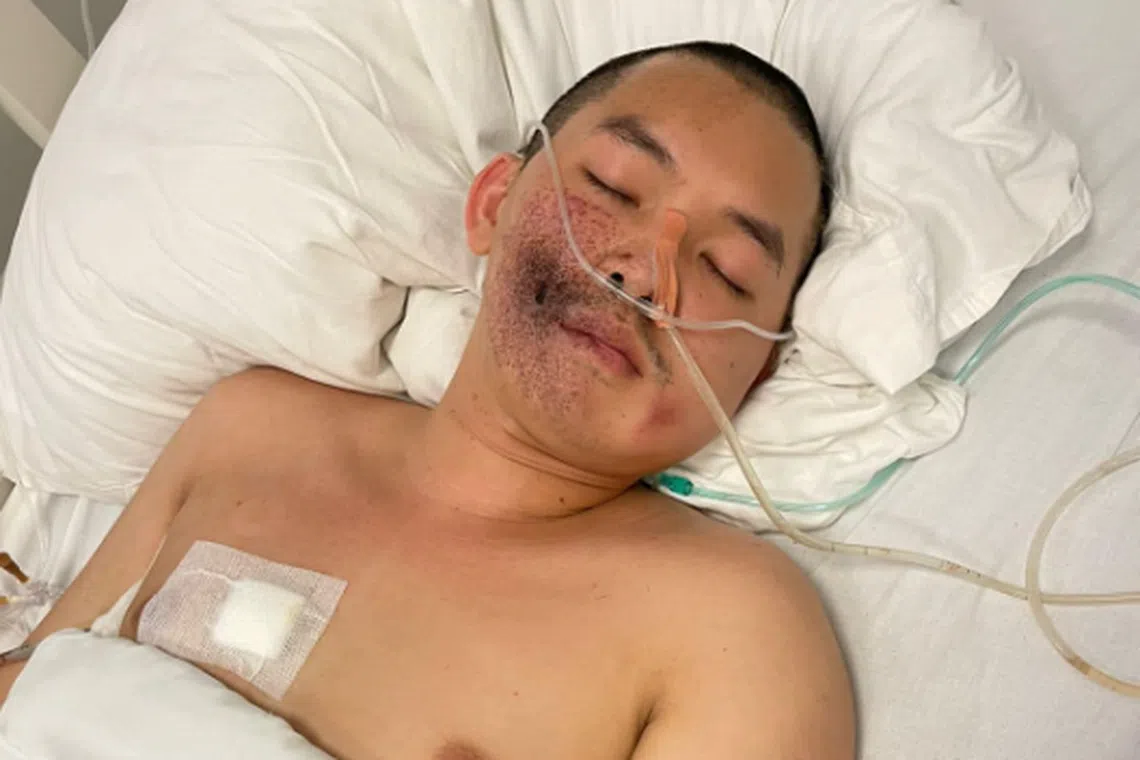 Mr Anousa “Jack” Luangsuphom was shot in the face and side in a Vientiane cafe on Saturday but survived the attack. 