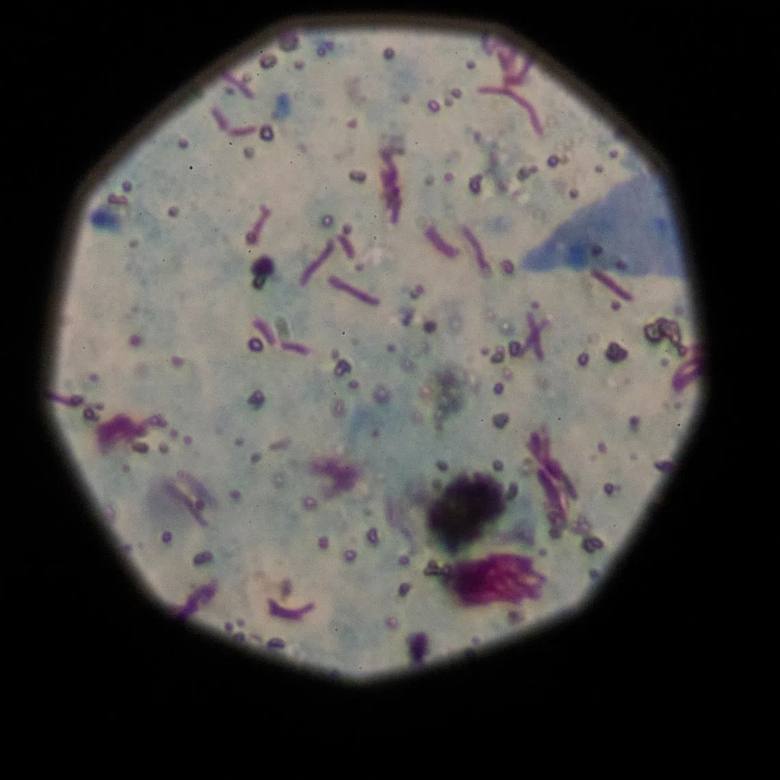 Tuberculosis is an infectious disease and is transmitted through the air to nearby close contacts.