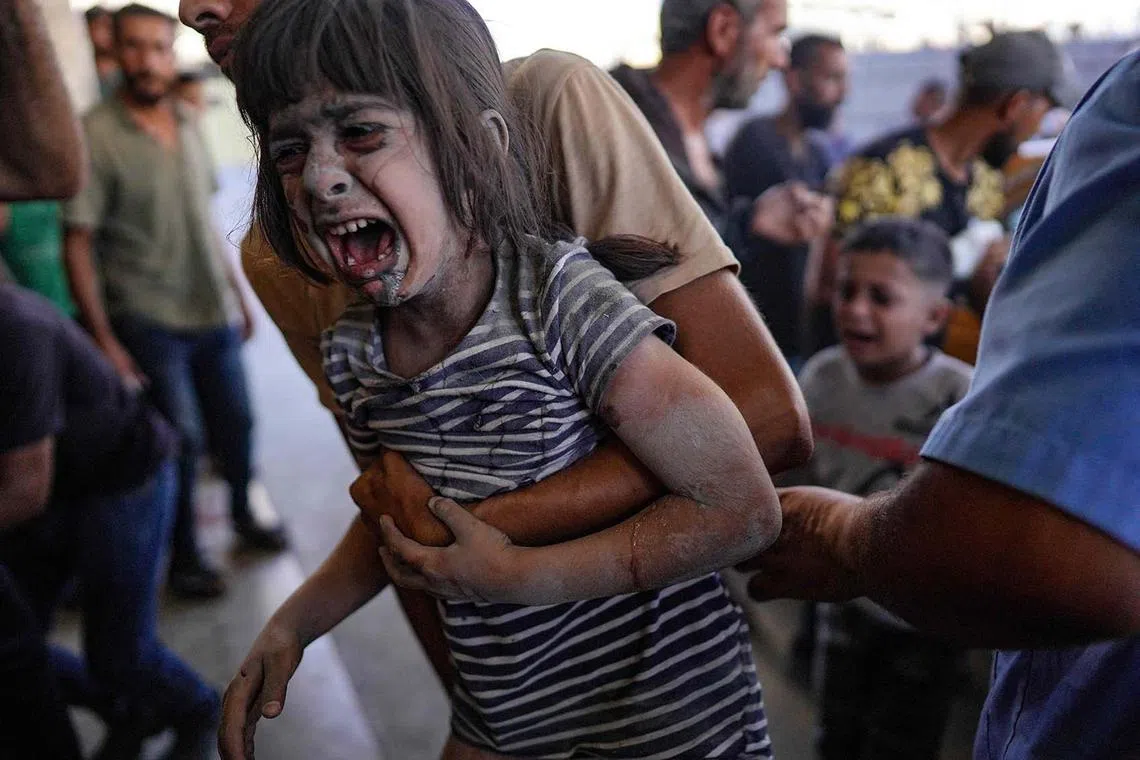 TOPSHOT - A Palestinian child injured in an Israeli strike reacts as she's carried to the Nasser Medical Complex in Khan Yunis in the southern Gaza Strip on August 21, 2024, amid the ongoing conflict between Israel and the Hamas militant movement. (Photo by Bashar TALEB / AFP)