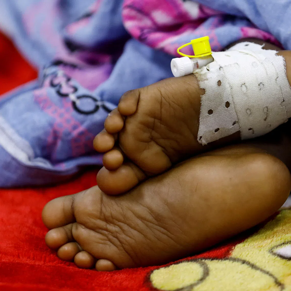 FILE PHOTO: A child suffering from diphtheria rests inside a ward at De Martino Public Hospital, following a diphtheria outbreak, in Mogadishu, Somalia August 13, 2025. REUTERS/Feisal Omar/File Photo