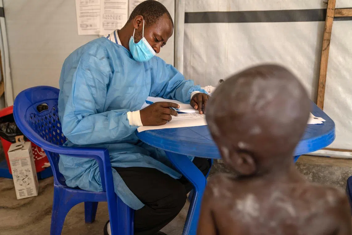 A medical staff member attends to a child suffering from mpox at the Munigi Health Centre in Munigi, Democratic Republic of the Congo, on Aug 19. 