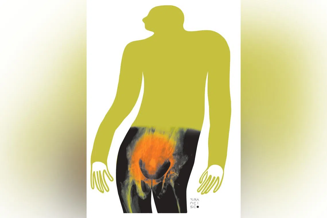 Smoking and obesity are associated with increased risk of several cancers and prostate cancer is no exception. 