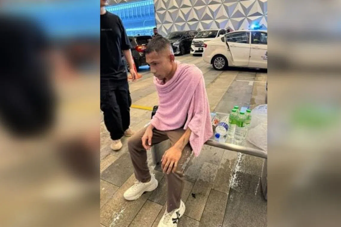 Faisal Halim was splashed with liquid believed to be acid when he was at a popular mall in Kota Damansara in Petaling Jaya. 
