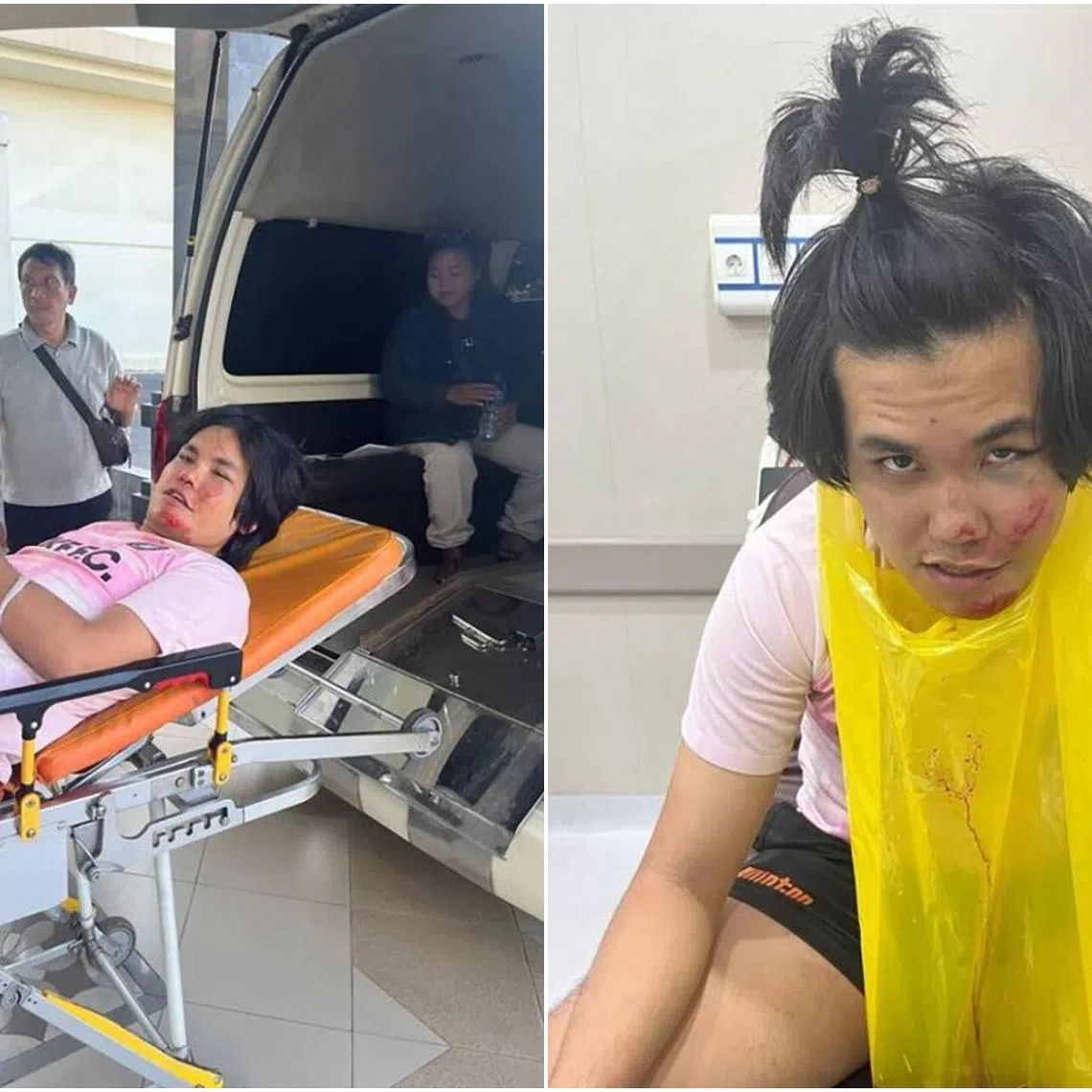 Mr Cheng Yu Heng experienced temporary memory loss as well as a fractured cheek.