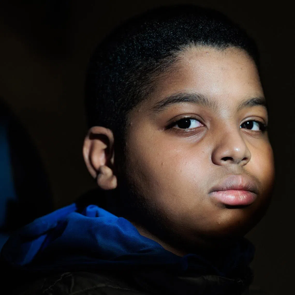 Aissam Dam, 11, is the first person to receive gene therapy in the US. for congenital deafness.