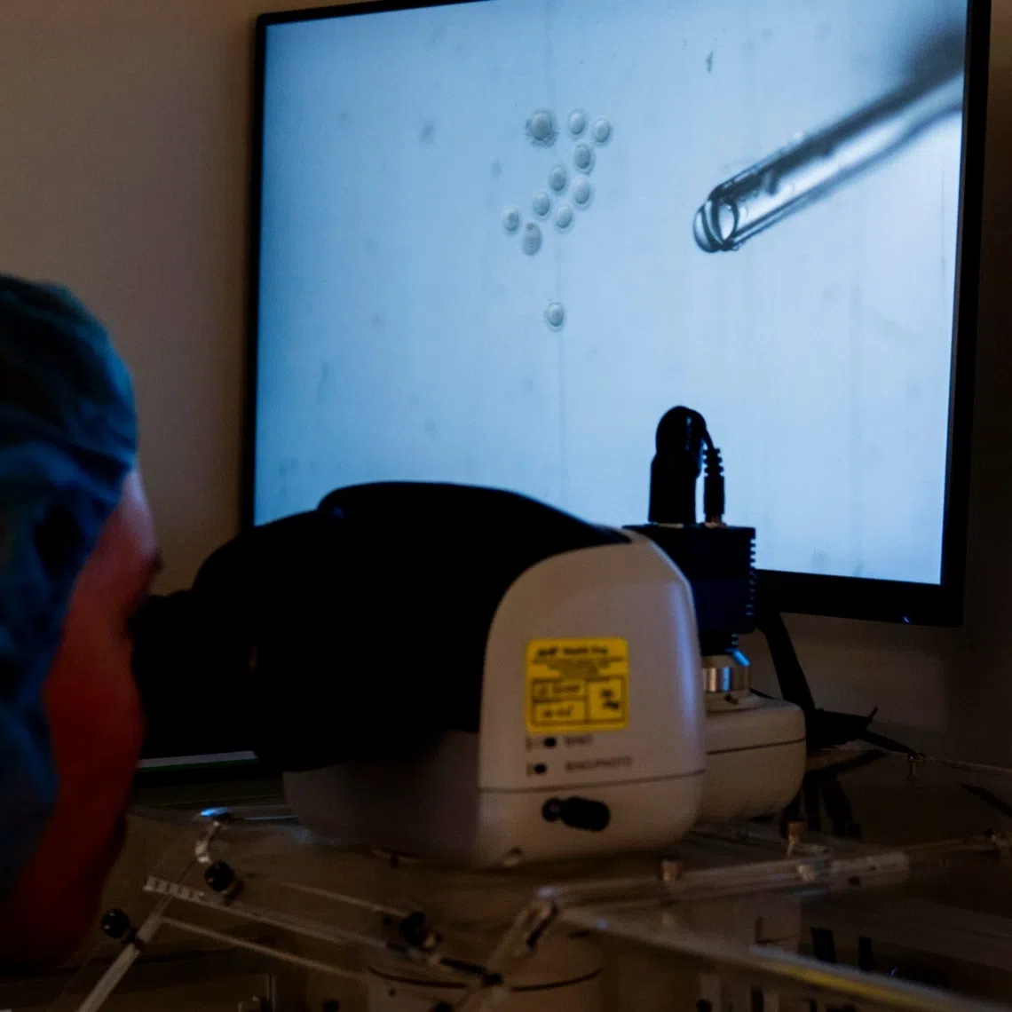 Sperm samples seen through STAR (Sperm Tracking and Recovery) technology at Columbia University Fertility Center in New York on Aug 7.