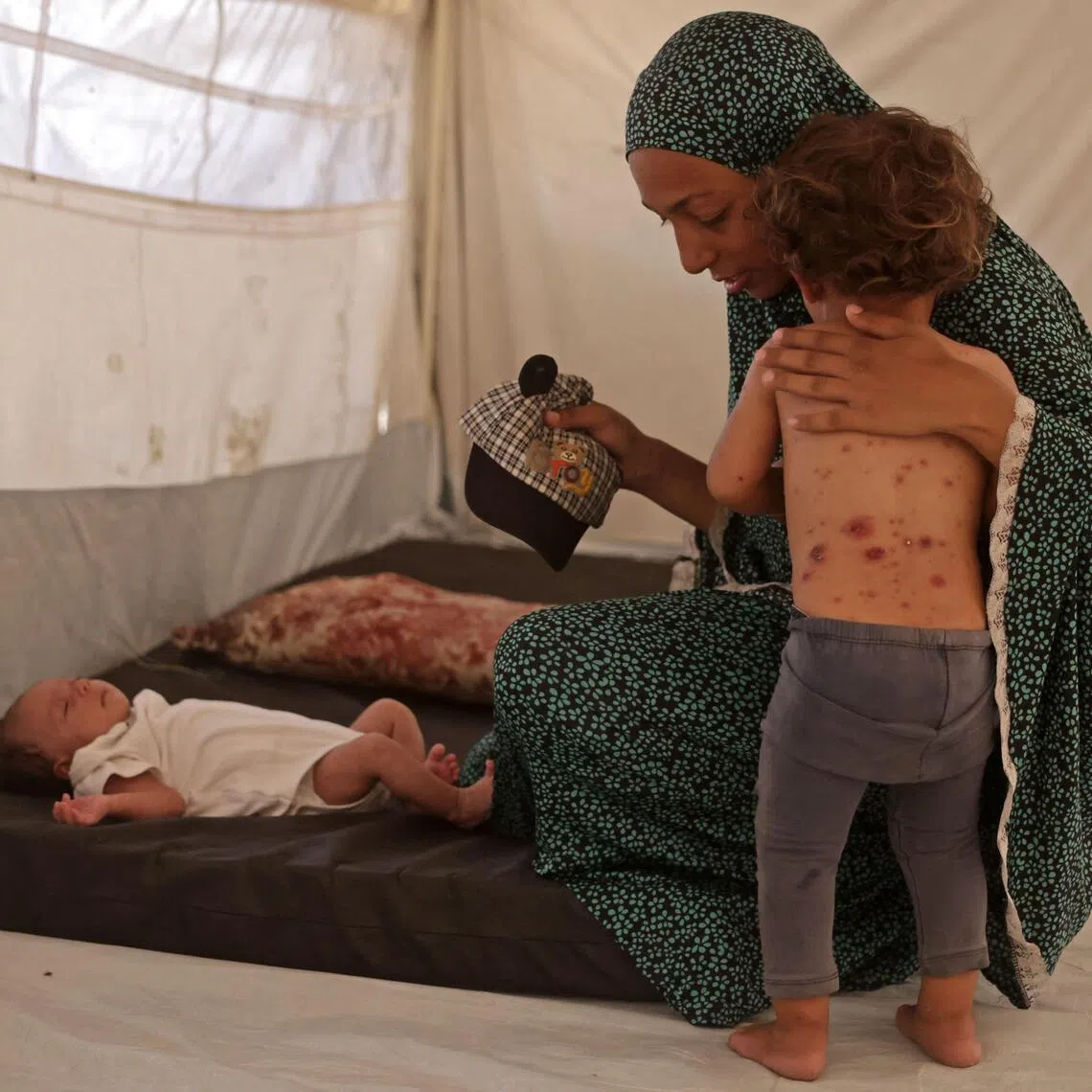 A displaced Palestinian girl suffering from chickenpox with her mother inside the family’s tent in Khan Younis on July 19.