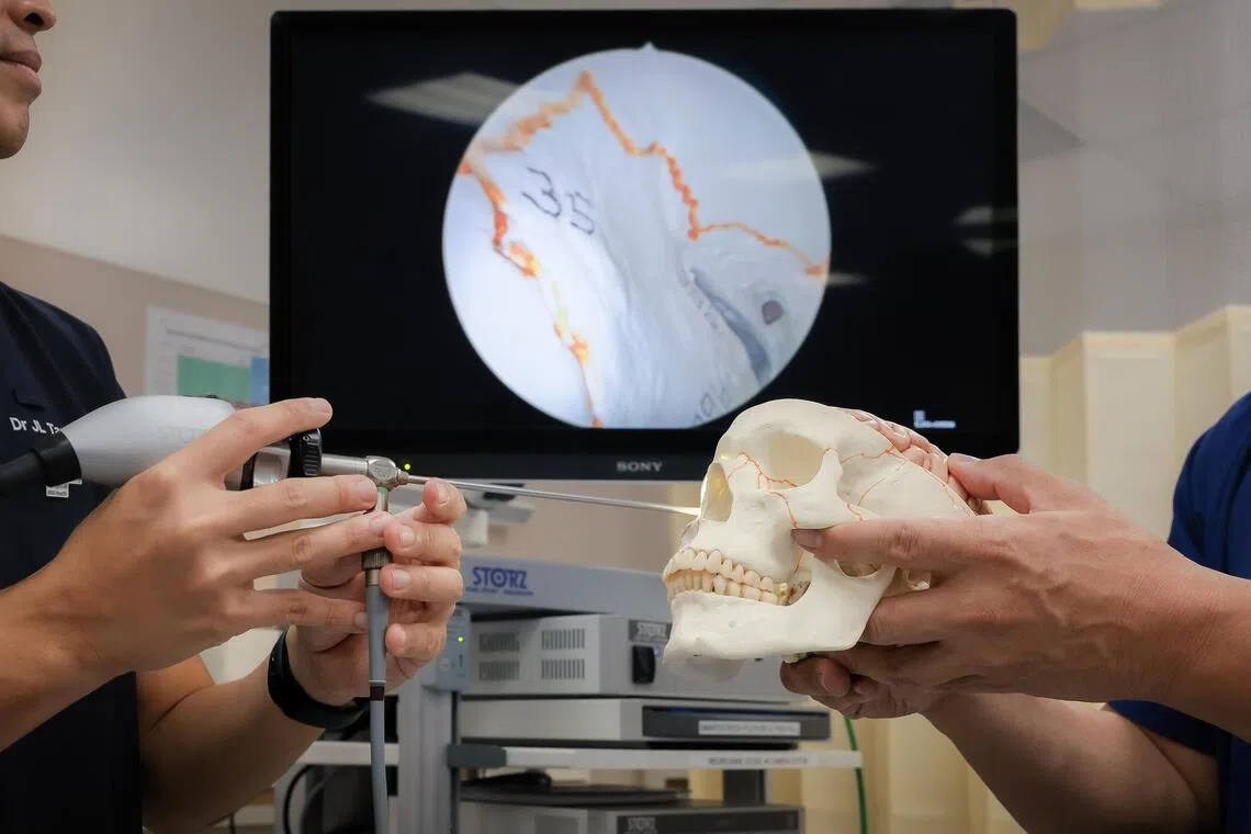 Surgeons perform first brain tumour removal through eye socket in ...