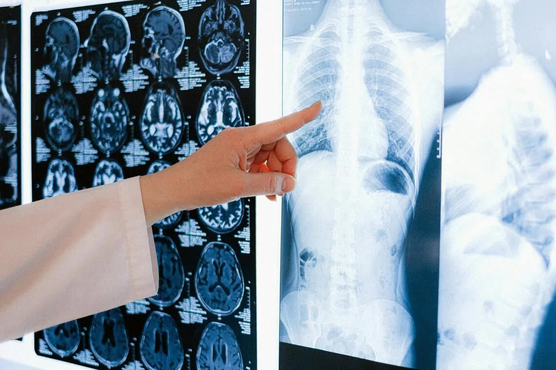 Only 41 per cent of 17 radiologists from 12 hospitals in six countries spontaneously identified AI-generated images.