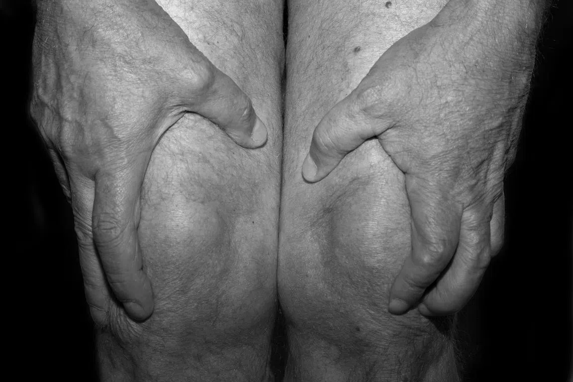 Scientists are racing to find ways to diagnose osteoarthritis earlier and stave off or slow some of the damage from the disease, which affects more than 500 million people worldwide. 