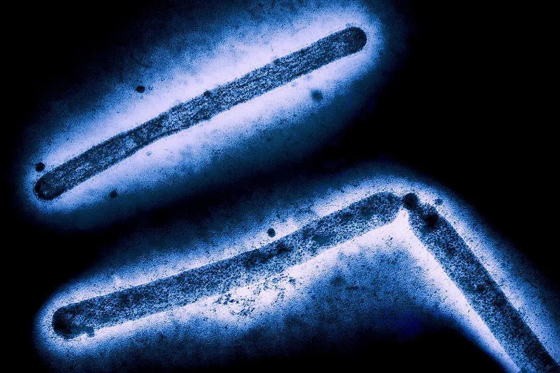 This undated handout image shows three influenza A (H5N1/bird flu) virus particles. 