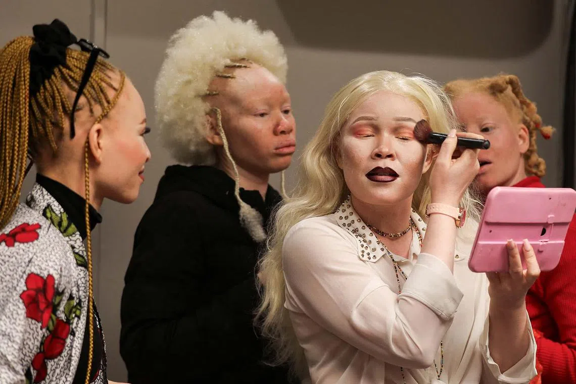 Contestants preparing for the Mr and Miss Africa Albinism pageant at the Crown Plaza hotel in Harare, Zimbabwe, June 28, 2025.