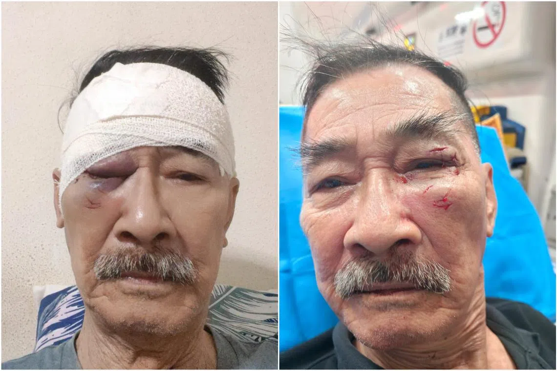 Security officer Kwek Moh Chai suffered lacerations and bruises after being punched by a man who he cautioned against sleeping on a public bench.