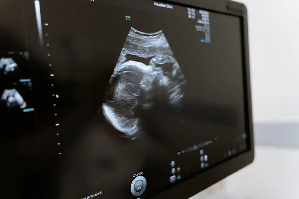 Florida’s Third District Court of Appeal dismissed without prejudice the petition filed on behalf of Natalia Harrell’s foetus.