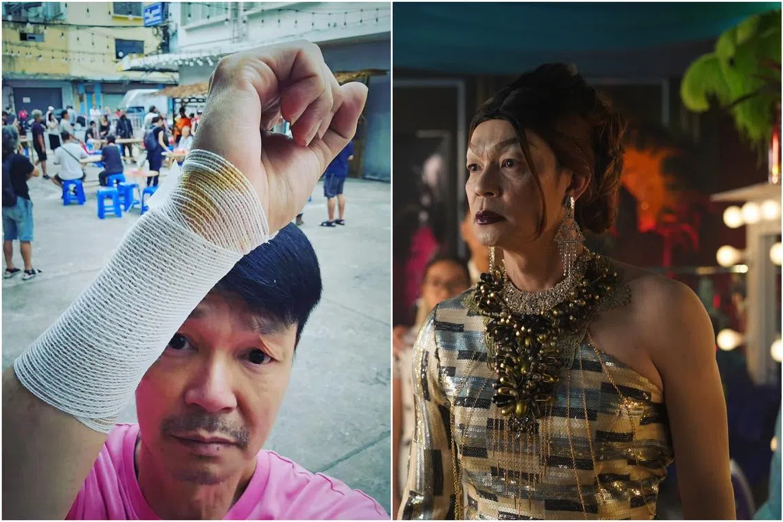 Actor Mark Lee posted on social media on July 9 a photo of himself with a bandaged arm.