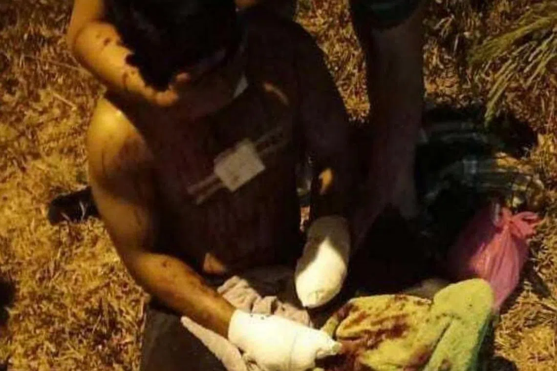 Other parts of the man's body were also injured as a result of the incident.