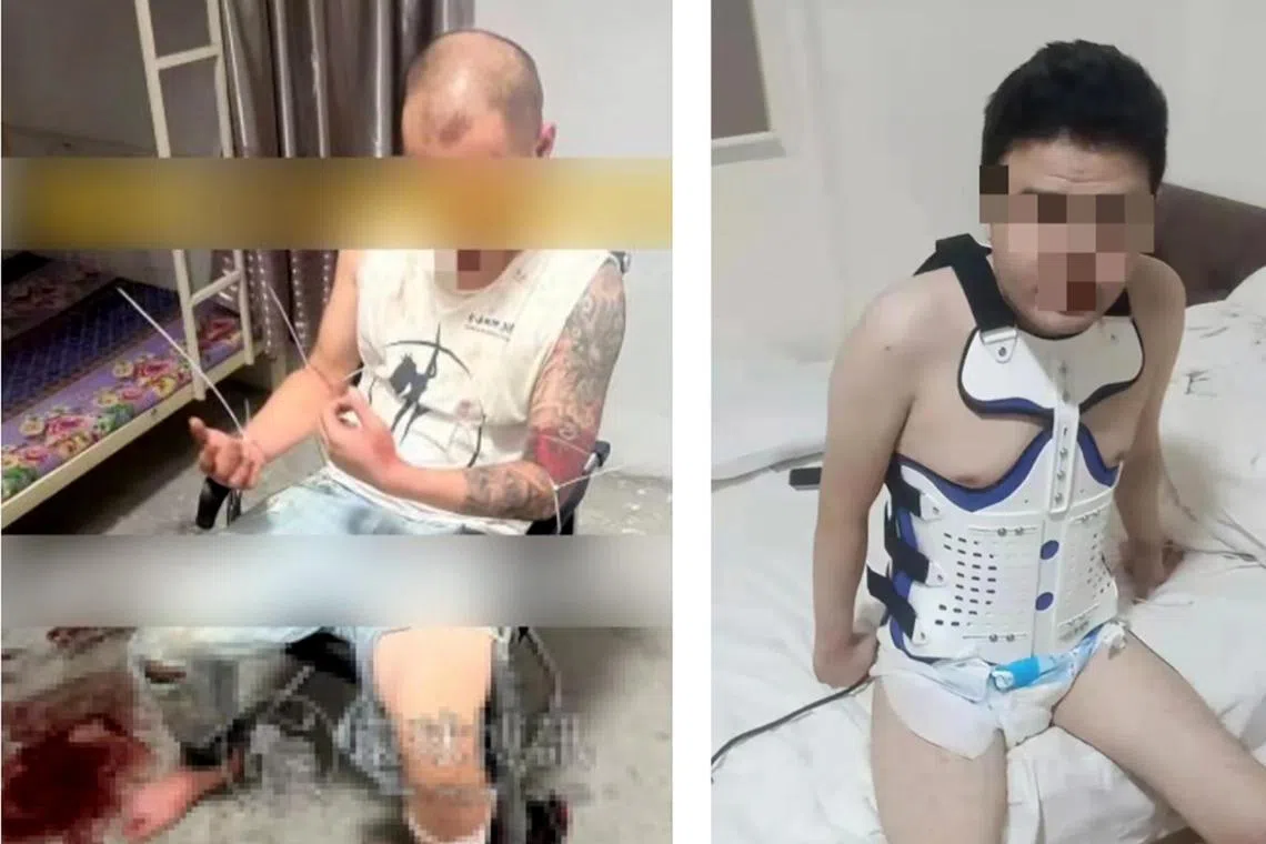 syscam13 - Left: A Taiwanese victim forced to work at a scam compound in Cambodia being tortured. He died in August 2022. 
Right: A Chinese victim who suffered injuries after jumping off the fourth floor of a scam compound in Cambodia.



Credit: Humanity Research Consultancy