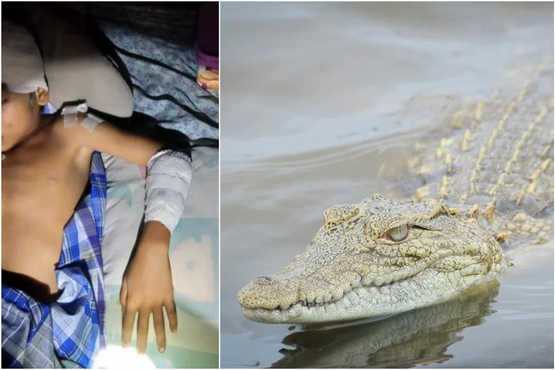 The boy managed to stave off the reptile after a struggle, though he was left with bites to his left hand, shoulder and head.