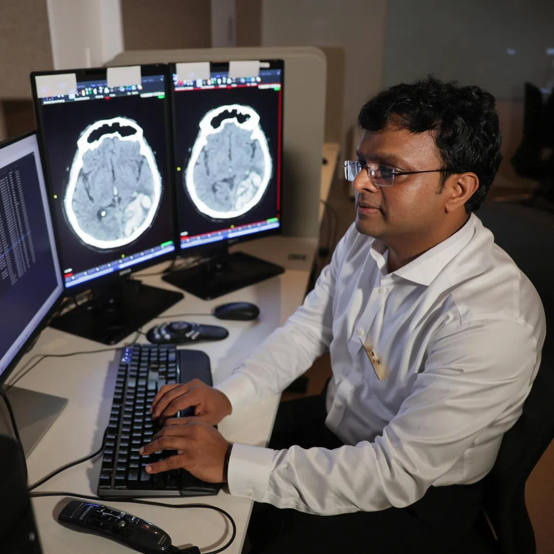 Analysis of CT brain scans had been made faster and easier with the use of AI, said senior consultant Sarat Kumar Sanamandra at from neuroradiology department of Singapore General Hospital and National Neuroscience Institute.