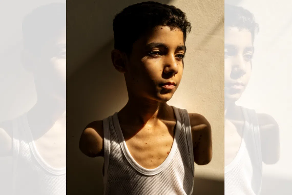 Mahmoud Ajjour, 9, upon realising his arms had been amputated, asked his mother: “How will I be able to hug you?”