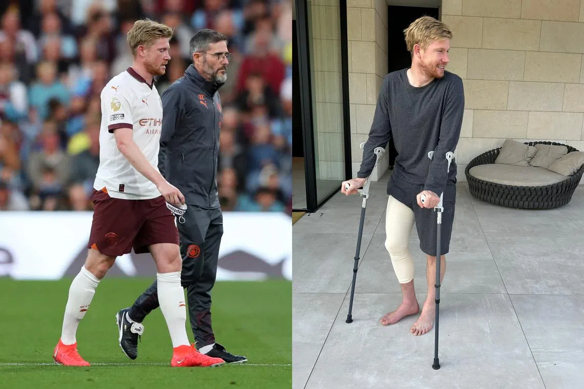 City's De Bruyne came off the pitch after 36 minutes of the champions’ 3-0 win at promoted Burnley a week ago, and City said he could be out for up to four months.