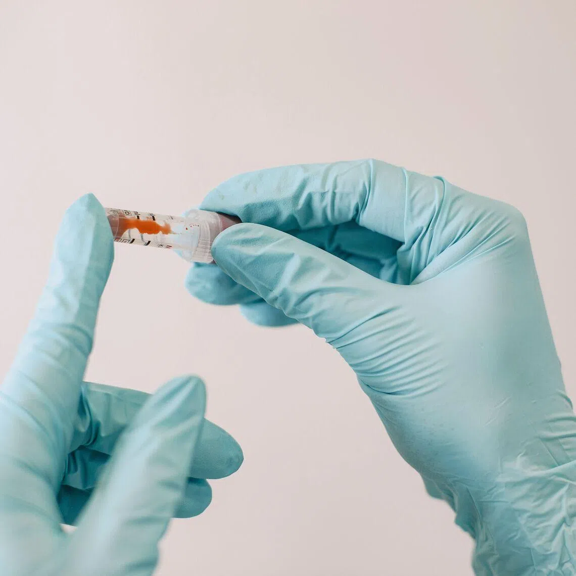 A six-year-old girl died from a severe immune reaction just days after receiving the experimental treatment.