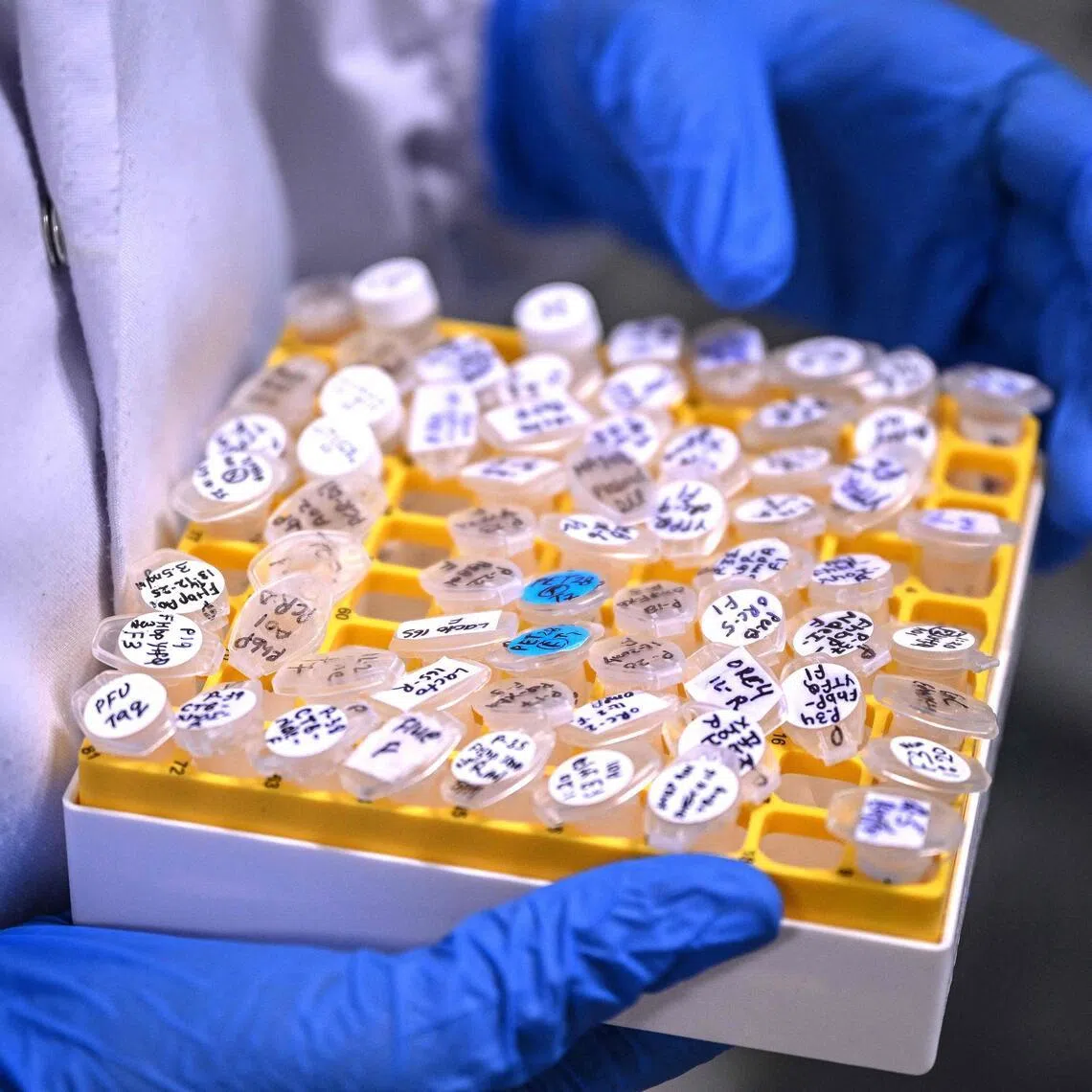 This photograph taken on January 29, 2026 shows a researcher carrying samples at the vaccine laboratory of Panacea Biotec, a pharmaceutical company in New Delhi. As dengue surges globally, an Indian vaccine candidate has entered the final stage of testing, raising hopes for one of the world's first single-dose shots against the deadly mosquito-borne disease. (Photo by Arun SANKAR / AFP)
