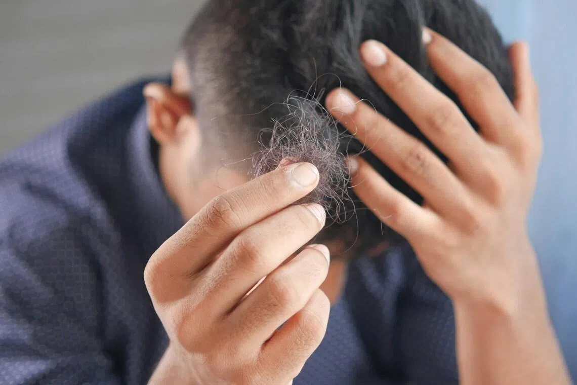 South Korea’s hair-loss insurance proposal sparks backlash