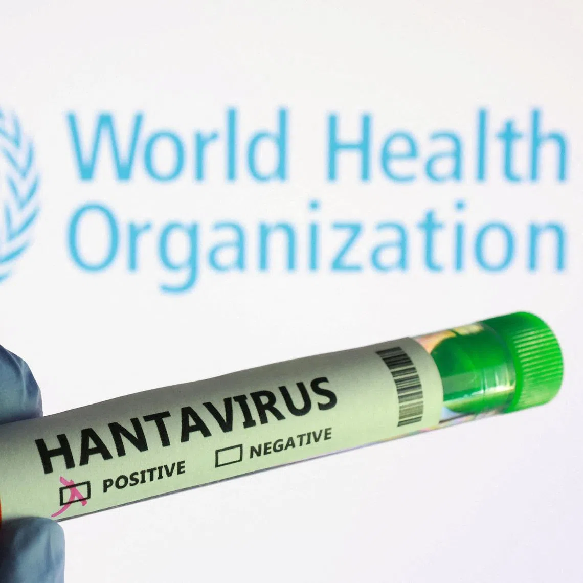A test tube labelled \"Hantavirus positive\" label and World Health Organization logo are seen in this illustration taken May 7, 2026. REUTERS/Dado Ruvic/Illustration