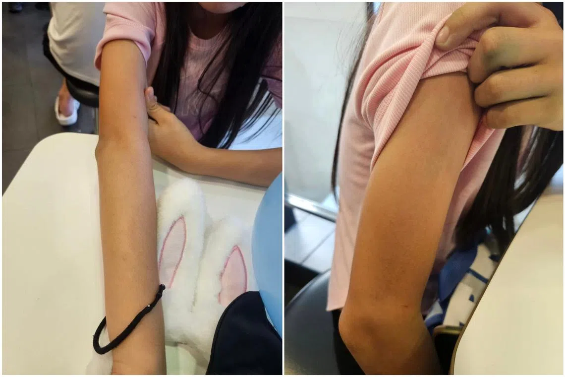 Ms Gwee's daughter sustained bruising on her upper arm as a result of the incident.