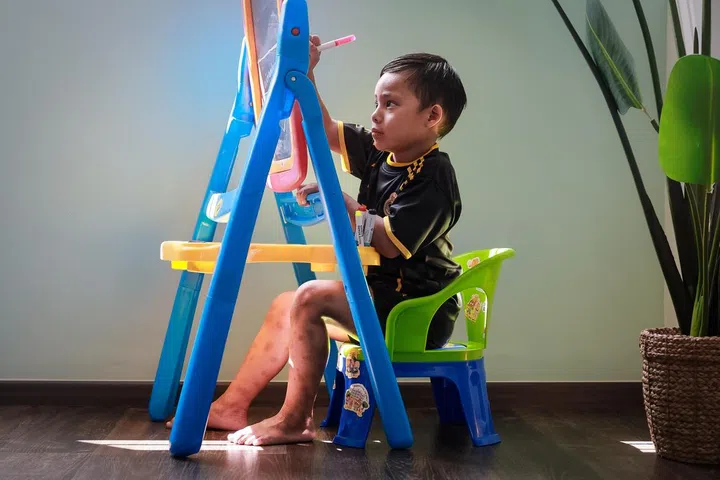 Faris Zafran, 5, who has severe eczema, drawing on a board in his home in Pasir Ris on Dec 7, 2024.
