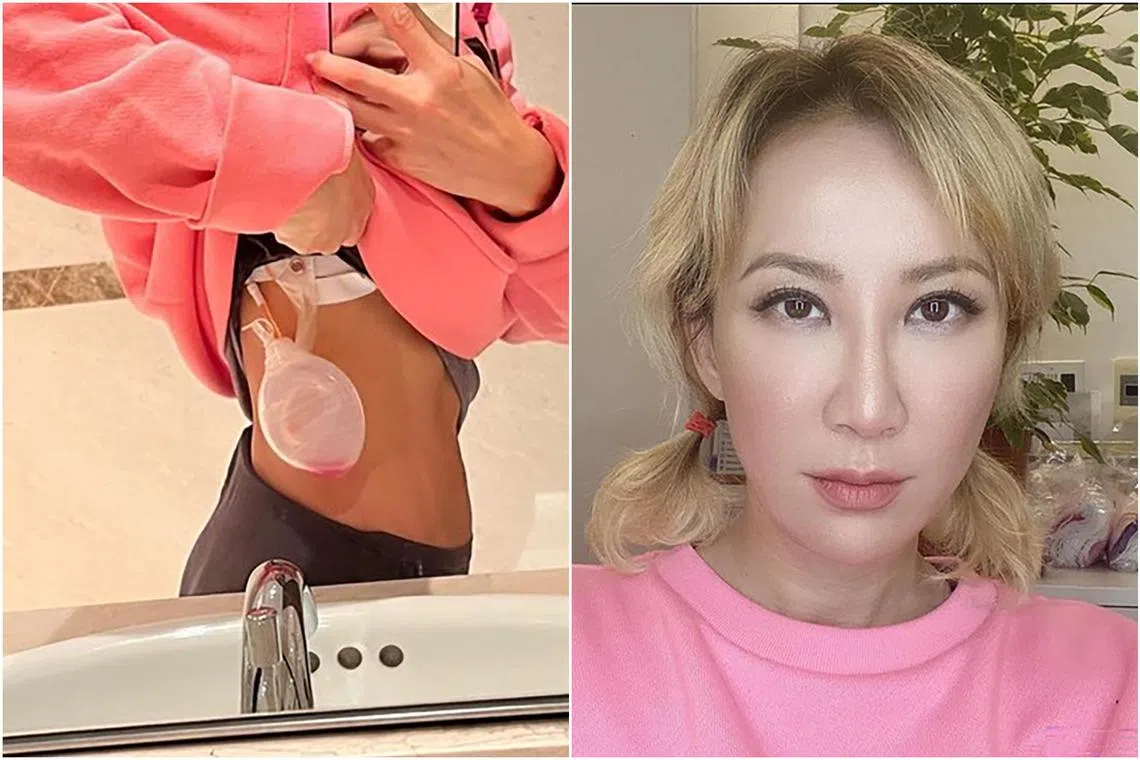Hong Kong-American diva Coco Lee posted a picture of what looked like a drainage bag on her body, sparking concern about her health.