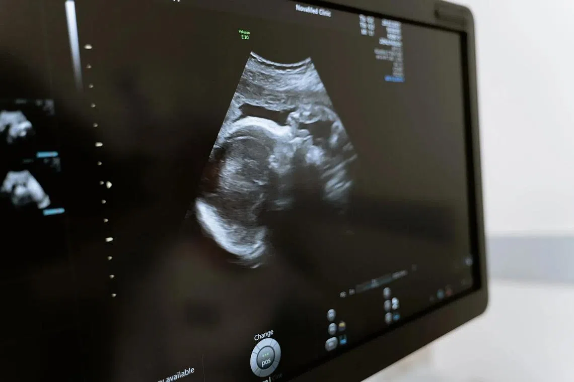 The story of the child’s abortion quickly went viral, reigniting political debate.