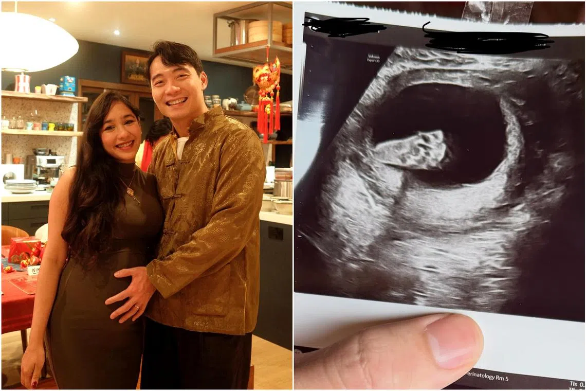 Nigel Ng disclosed on social media on Feb 20 that his wife Sabrina Ahmed is pregnant.