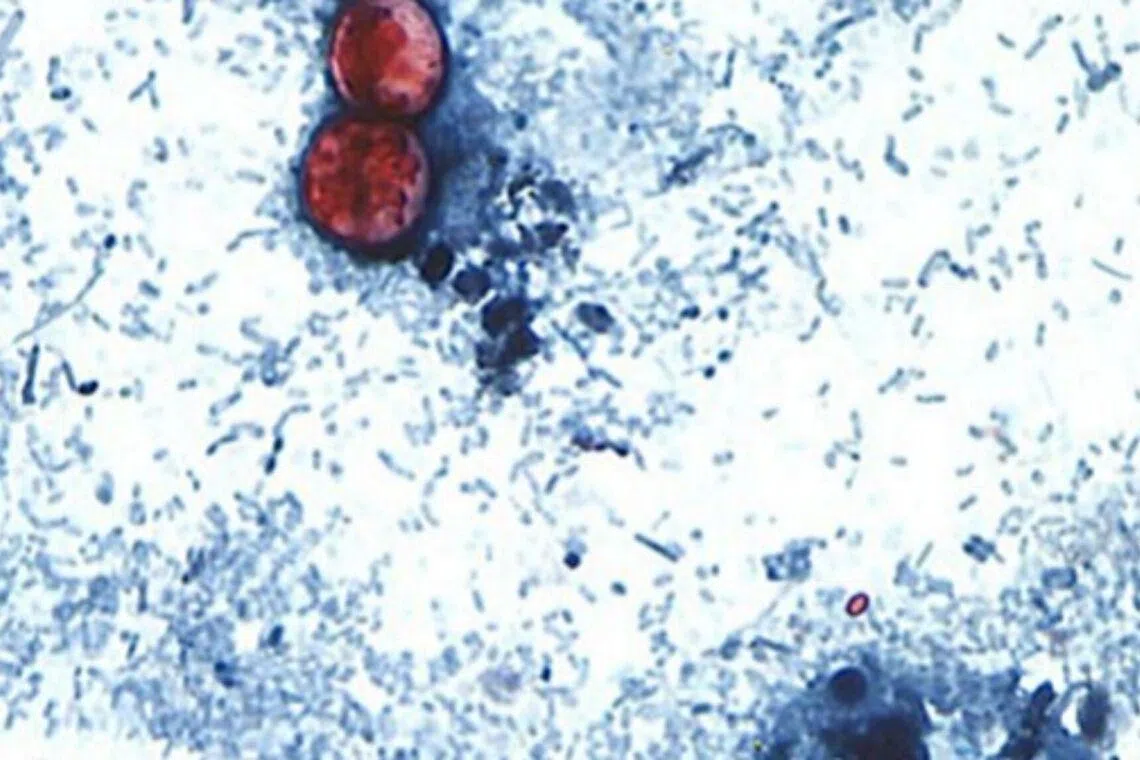 Cyclosporiasis can cause frequent watery diarrhoea for a few days or even months, according to the US Centers for Disease Control and Prevention.