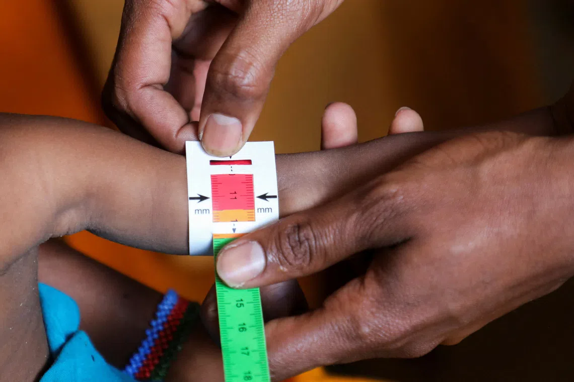 Somalia faces child malnutrition crisis as aid cuts close facilities
