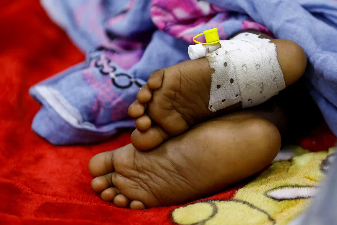 FILE PHOTO: A child suffering from diphtheria rests inside a ward at De Martino Public Hospital, following a diphtheria outbreak, in Mogadishu, Somalia August 13, 2025. REUTERS/Feisal Omar/File Photo