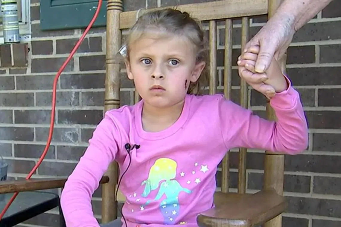 Screengrab from WSOC-TV

Six-year-old shot