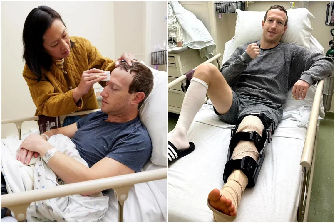 Tech billionaire Mark Zuckerberg said in an Instagram post that he tore one of his ACLs while training for a fight in early 2024.