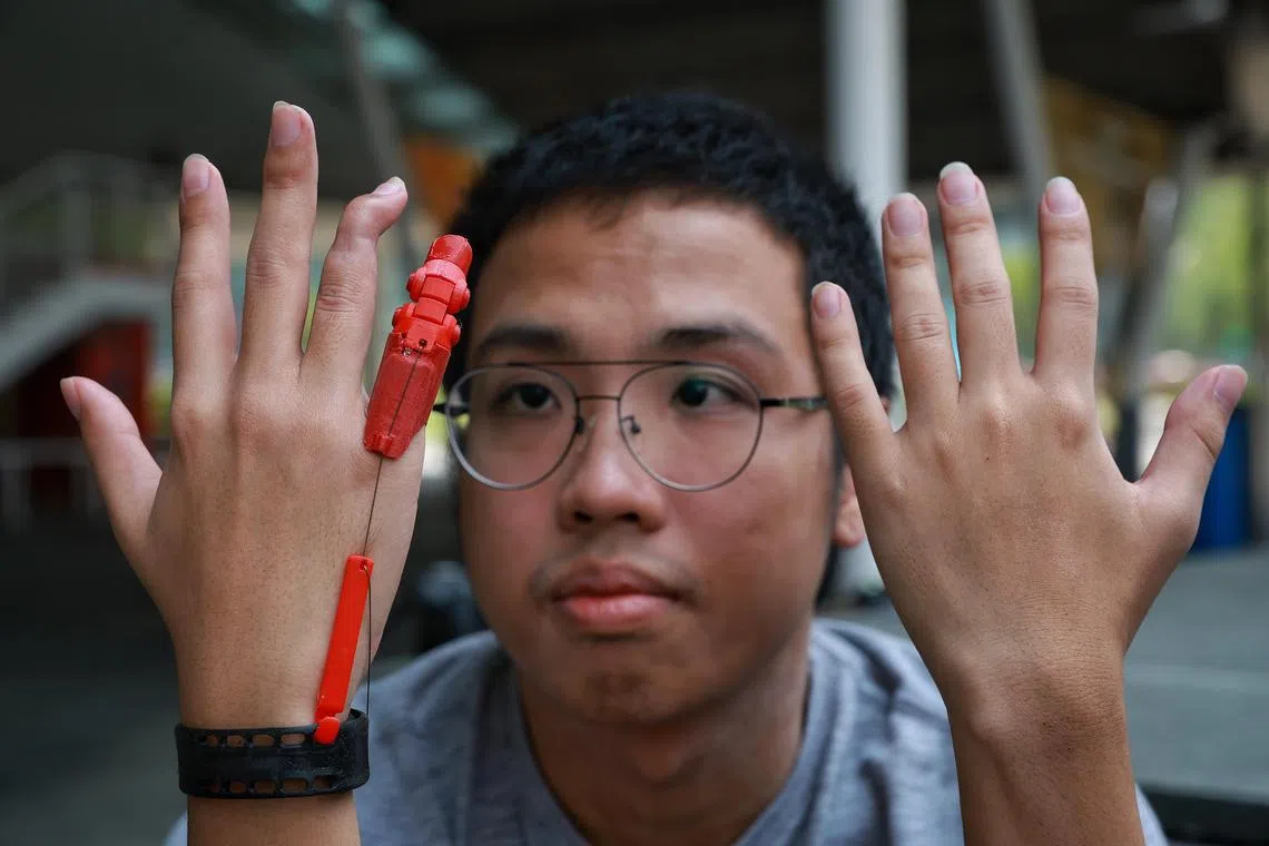 Polytechnic student Russel Ko, who lost his last finger in a motorcycle accident, with his 3D-printed functional finger prosthesis.