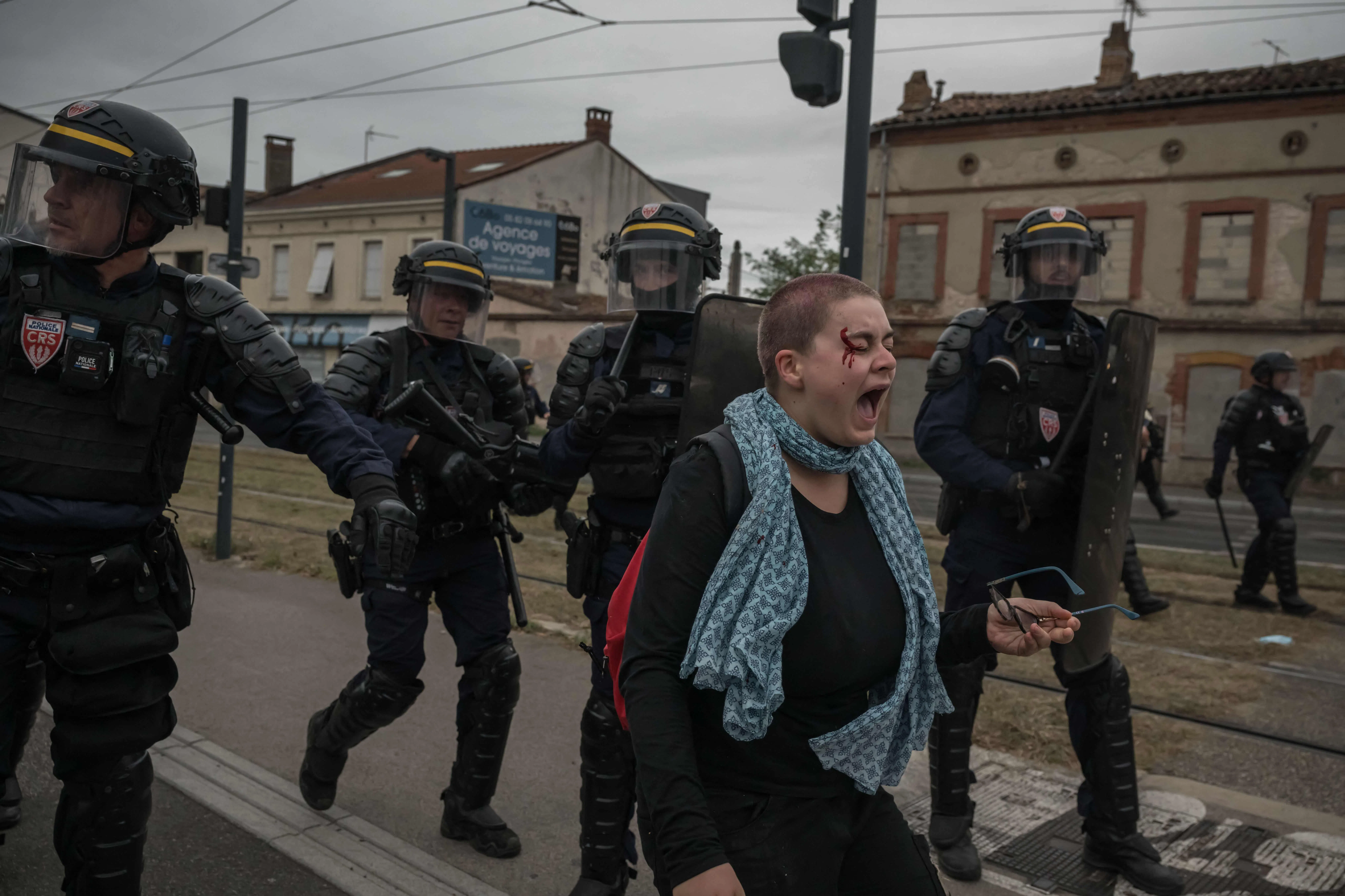 An injured protester screaming in front of riot police near a high school in Toulouse, south-western France, on Oct 1, as high school students demonstrate countrywide over what they denounce as poor learning conditions.