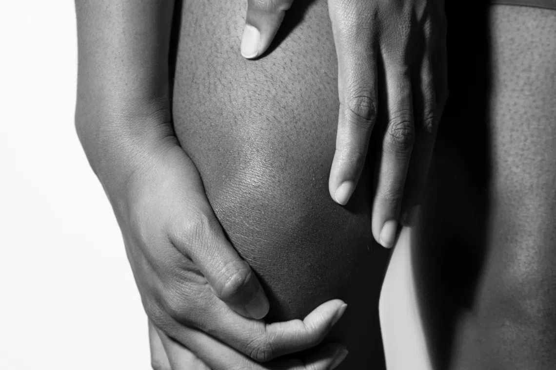 Knee osteoarthritis, which develops in four stages as cartilage in the joint wears down, is a long-term condition that cannot be reversed.