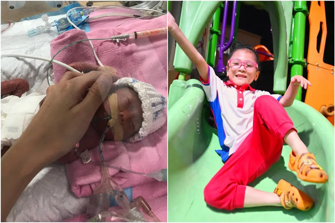 Chelsea Kiew was born extremely premature at 22 weeks of pregnancy, and she is the only baby born in Singapore at 22 weeks in the past decade to have survived. 