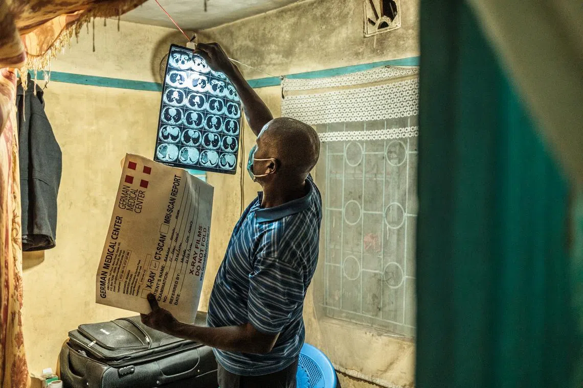 Tuberculosis patient Barack Omondi looking at his CT scan at his home in the Kenyan capital Nairobi.