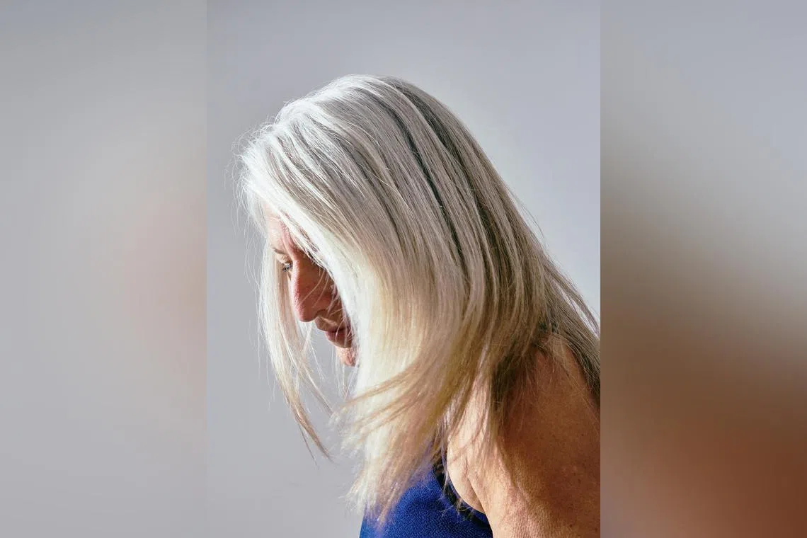 Premature hair greying is driven mainly by genetics.  