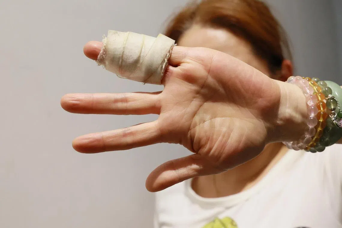 Ms Ng said she spent more than $200 on medication at the emergency department afterwards, and added that she will be seeing an orthopedic doctor for further treatment.